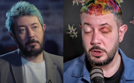 Фрик медалист