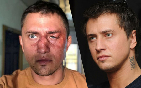 Звезду «мажора» Павла Прилучного жестоко избили в Москве